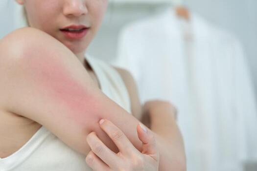 Rashes and Allergies