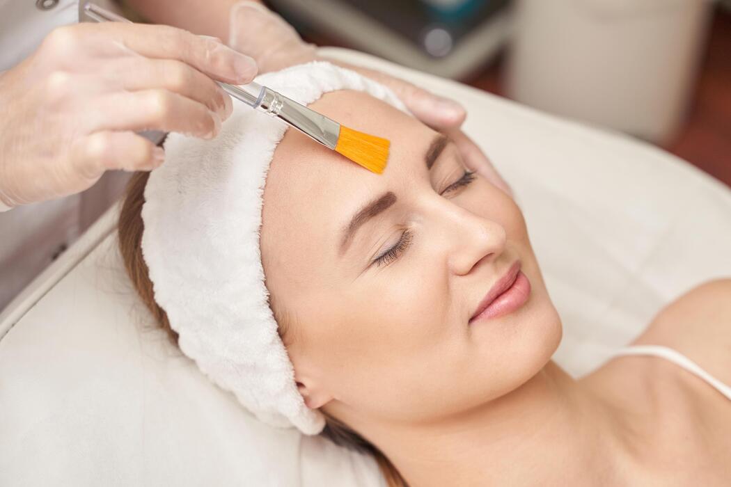 Are Chemical Peels Worth It for Uneven Skin Tone and Dull Skin?
